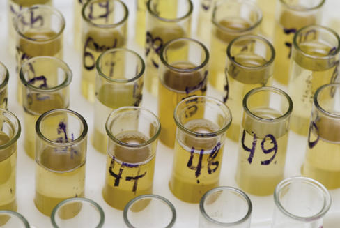 O que revela a cor da urina?