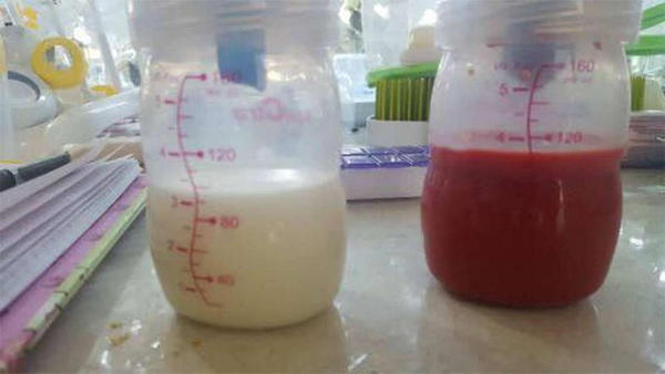 Uma mulher produz leite materno vermelho